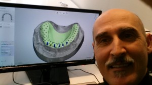 3D scan ganeplade