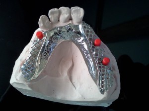 cropped-implantat-protese.jpg